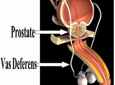 Does flonase affect the prostate